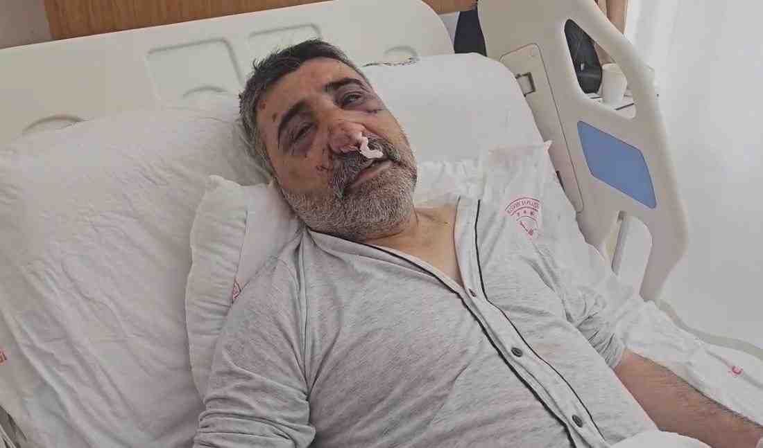 İstanbul’da Taksi Şoförüne İngiliz Boksörden Şiddet: “Elini Gözüme Sokup Isırdı” Eyüpsultan’da Dehşet Gecesi: Turistten Saldırıİstanbul Eyüpsultan’da bir taksi şoförü, aracına