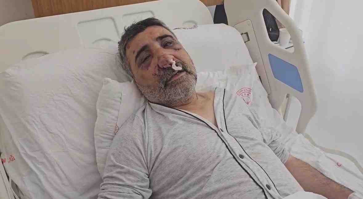 Eyüpsultan’da Dehşet Gecesi: Turistten Saldırıİstanbul Eyüpsultan’da bir taksi şoförü, aracına