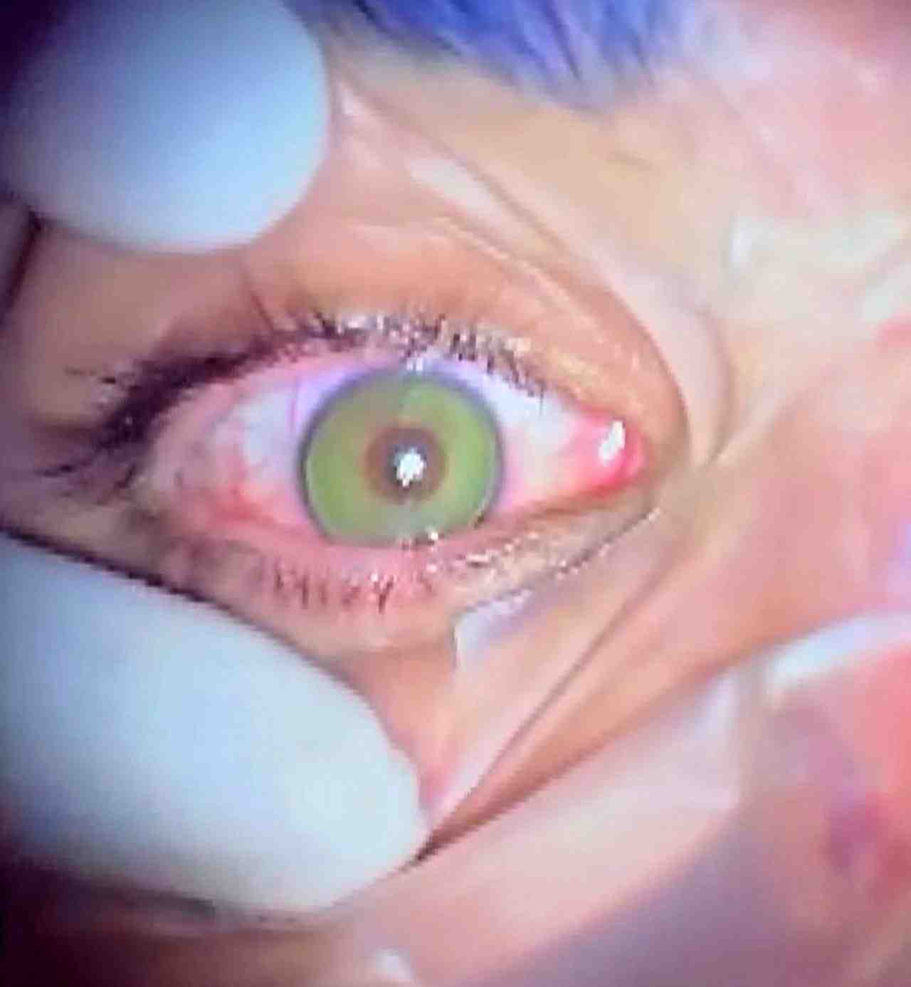 Antalya’da görev yapan göz hastalıkları uzmanı Op. Dr. Birgi Sönmezer,