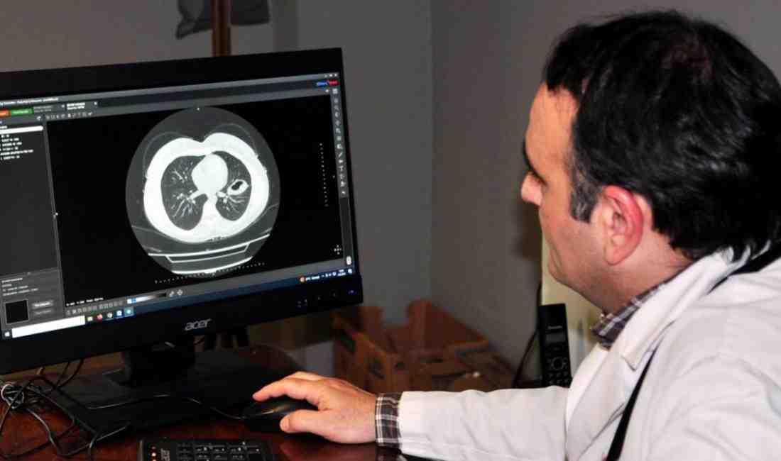 “Köpek Kisti” Hayati Tehlike OluşturuyorKars Harakani Devlet Hastanesi Göğüs Hastalıkları