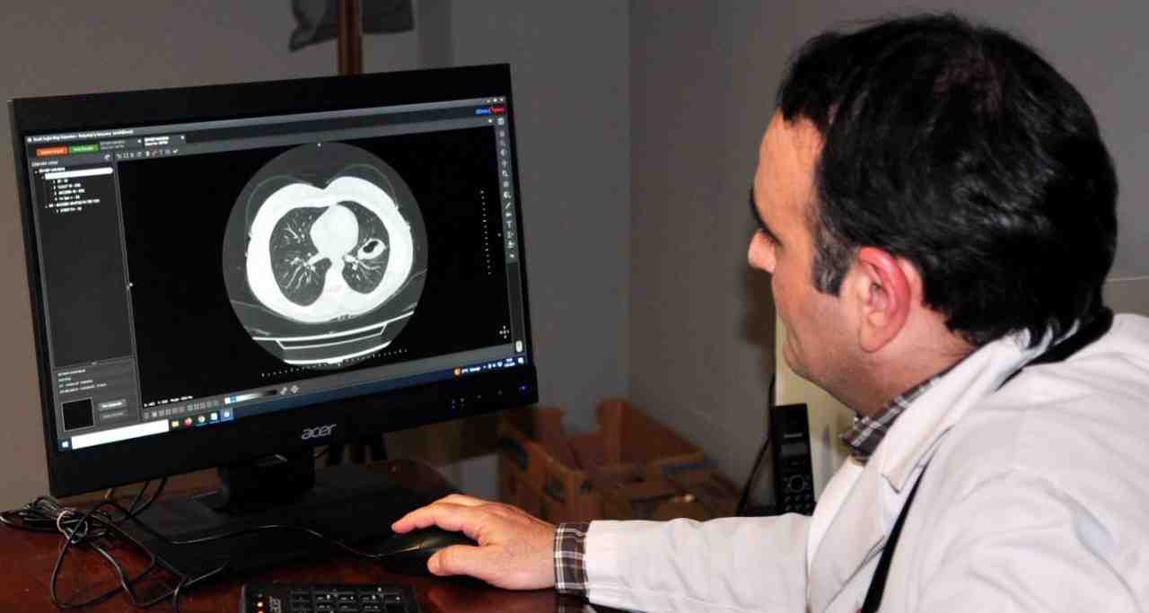 “Köpek Kisti” Hayati Tehlike OluşturuyorKars Harakani Devlet Hastanesi Göğüs Hastalıkları