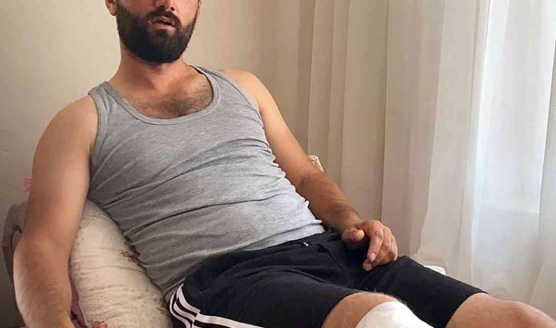 Tarlada Sulama Yapan Fatih Polat, Ayı Saldırısına Uğradı Iğdır’ın Karakoyunlu