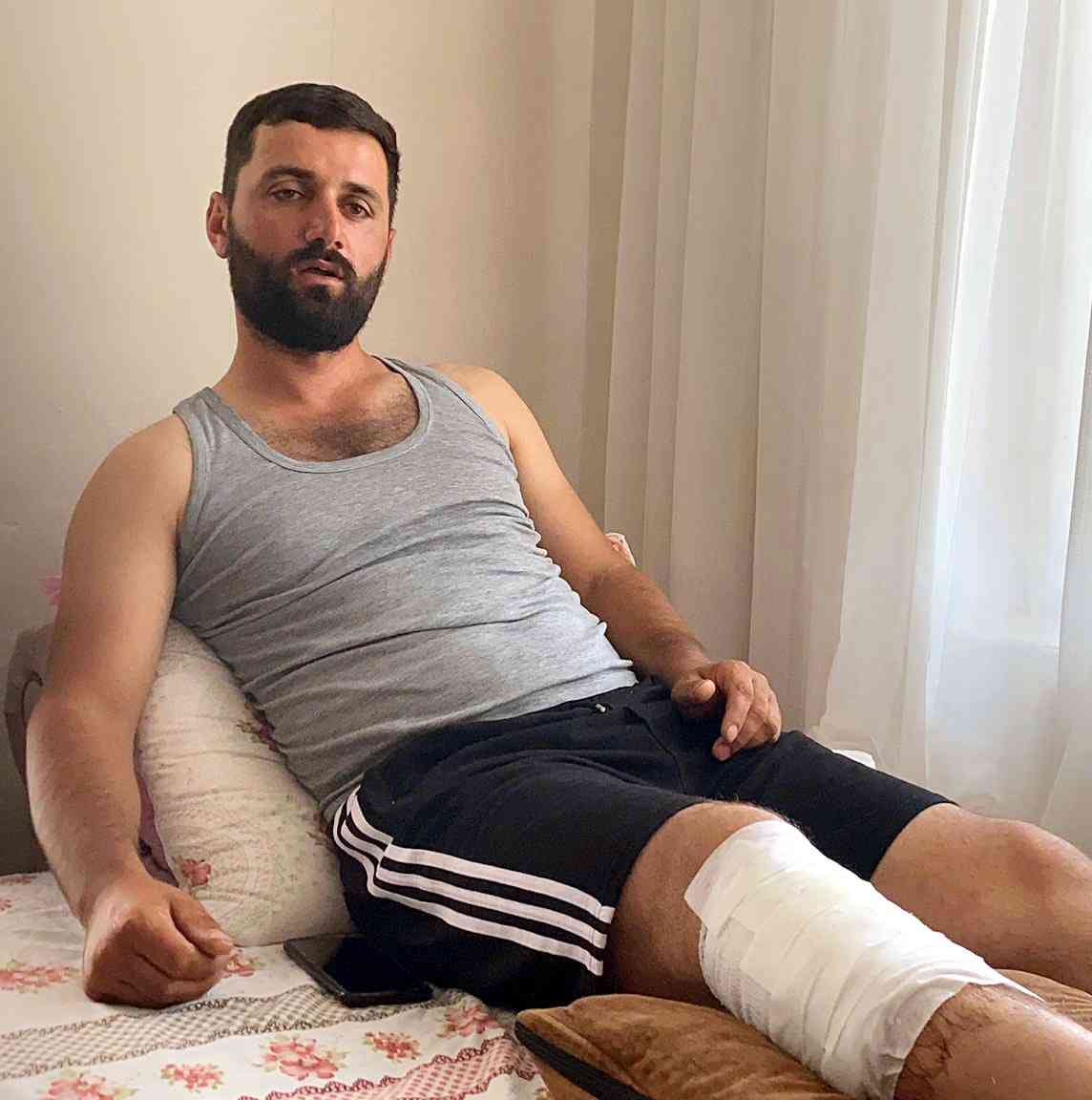 Tarlada Sulama Yapan Fatih Polat, Ayı Saldırısına Uğradı Iğdır’ın Karakoyunlu