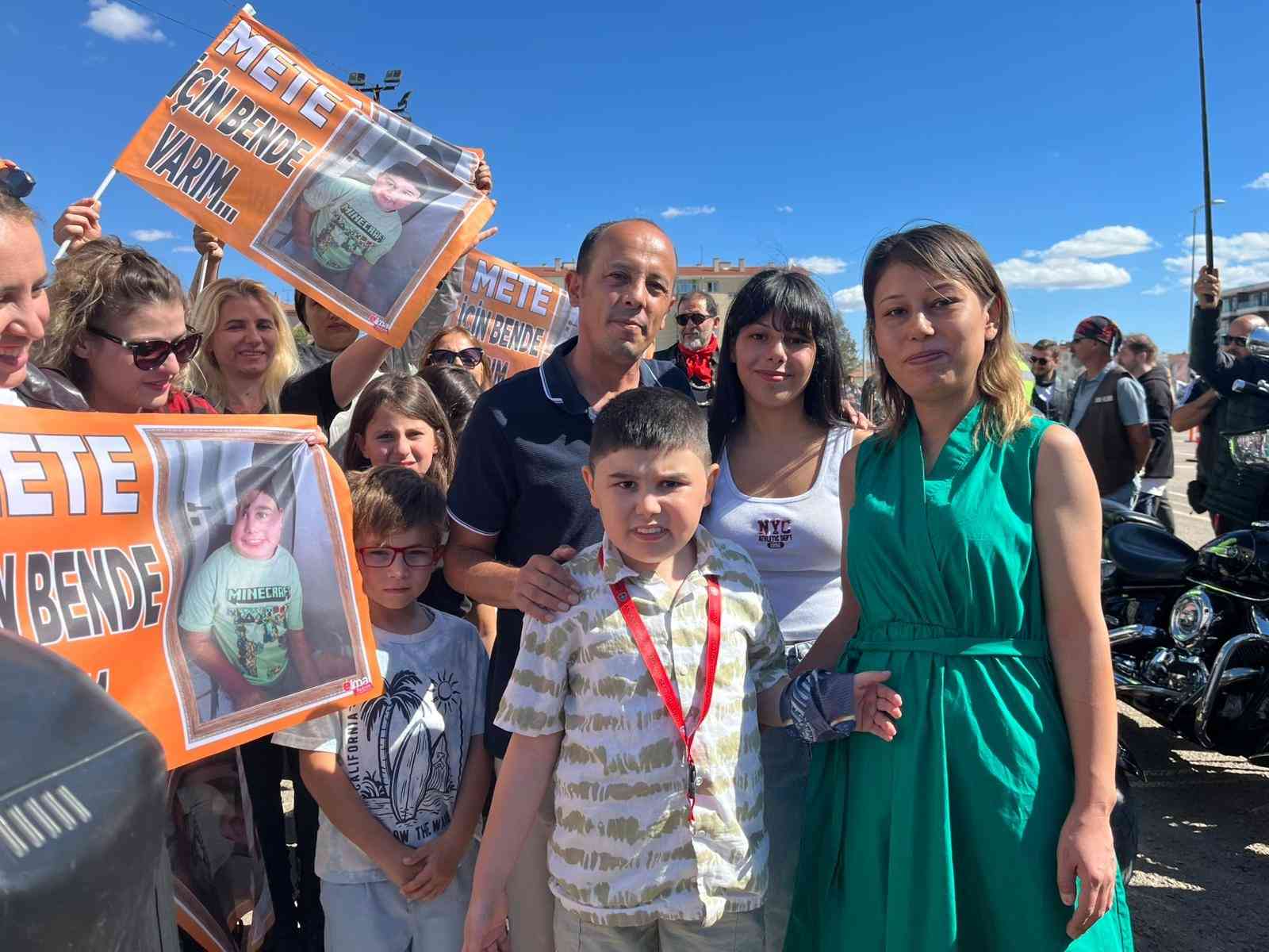 &nbsp; Ankara’da Duchenne Musküler Distrofi (DMD) hastalığıyla mücadele eden 10