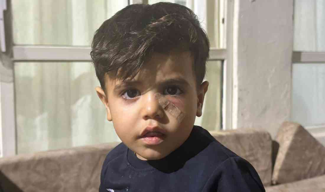 Şanlıurfa’nın Akçakale ilçesinde evinin avlusunda oynayan 4 yaşındaki Ömer Faruk