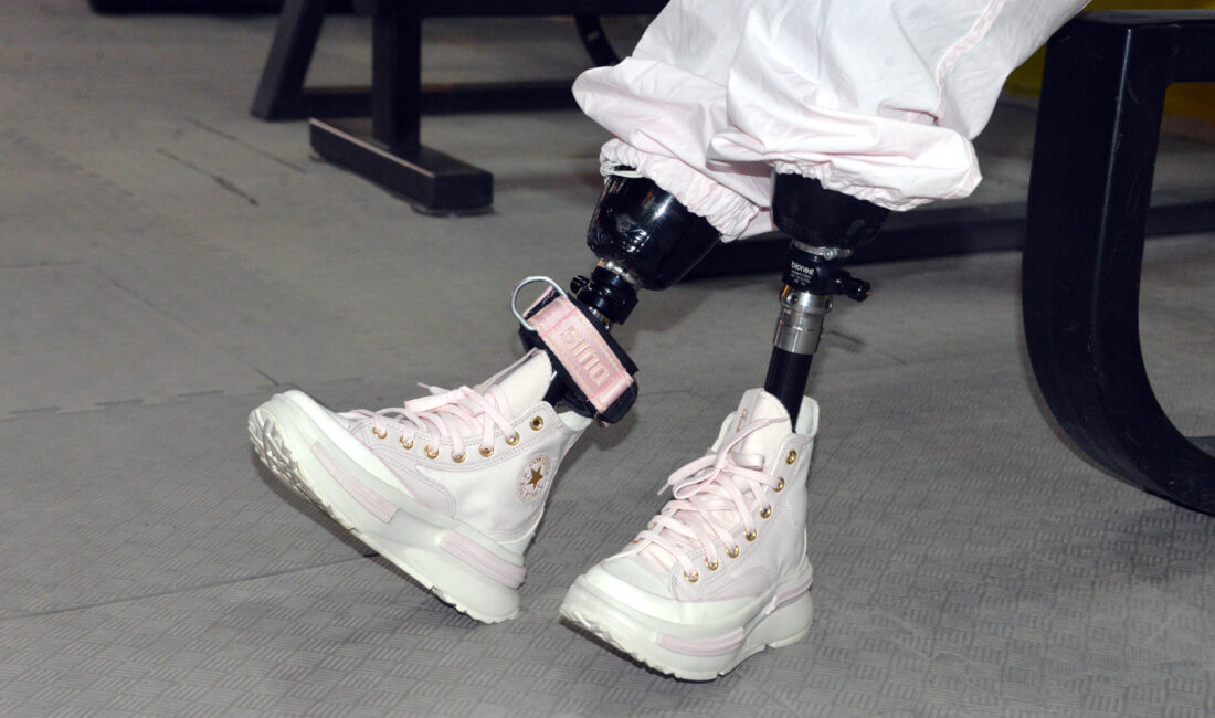 &nbsp; İrem Karatutlu: “Benim İki Bacağım ve Bir Can Bu