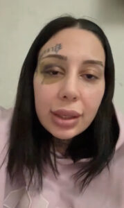 Boşanma Aşamasındaki Eşini Darbeden Saldırgan Tutuklandı İstanbul Kağıthane’de 13 Aralık