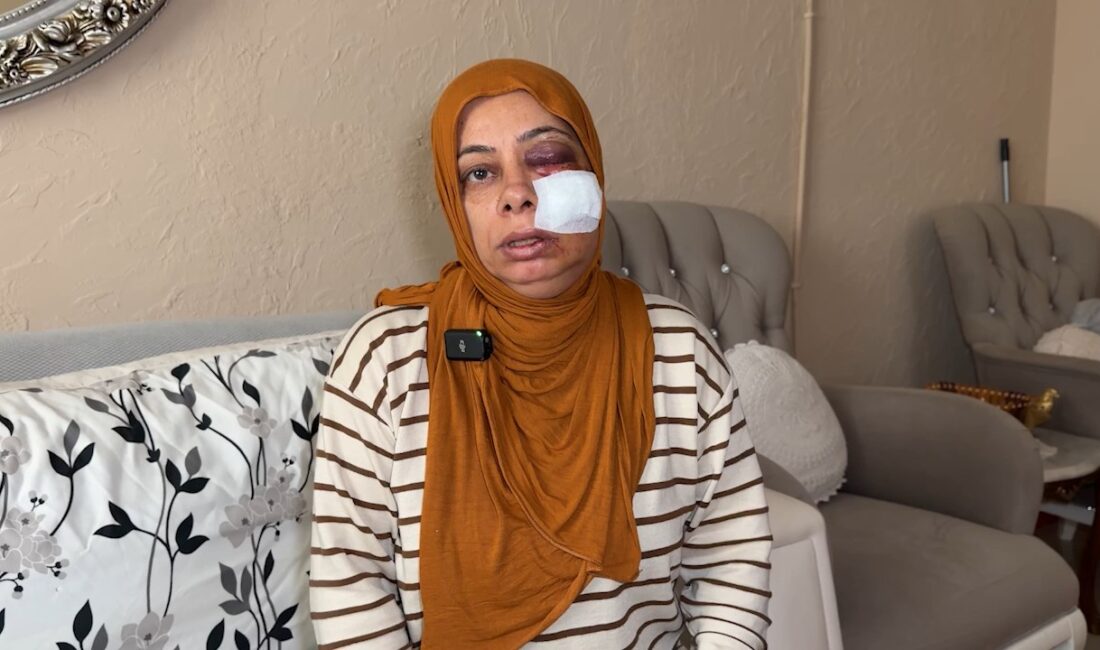 Hatay‘ın İskenderun ilçesinde, elektrikli bisikletiyle akraba ziyaretine giden Şükriye Arıcı