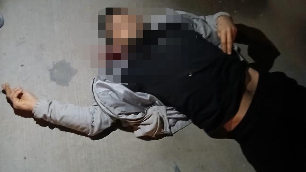 Sakarya’nın Erenler ilçesinde çıkan aile içi kavgada, ağabeyi tarafından pompalı