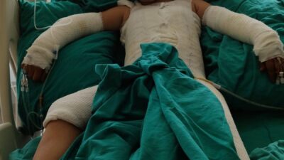 ADANA’nın Seyhan ilçesinde, evinin damında uçurtma uçururken elektrik trafosuna kapılan