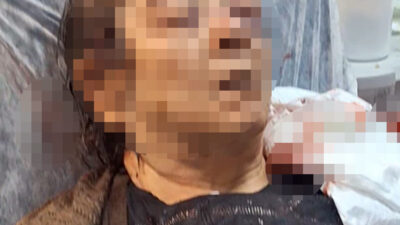 Kayseri’de evinde oturduğu sırada tavandan kopan moloz yığınının altında kalan