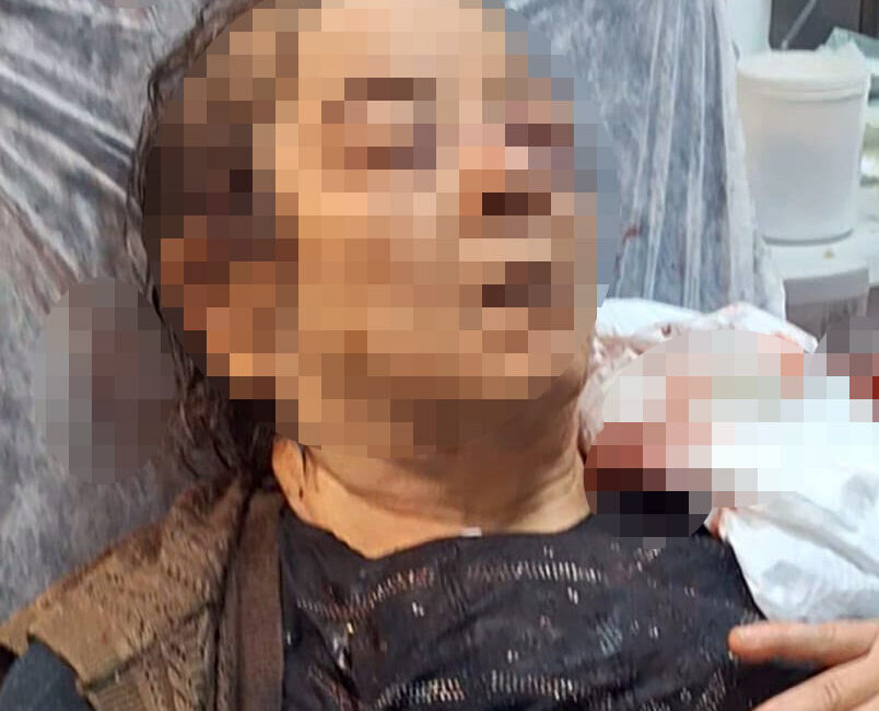 Kayseri’de evinde oturduğu sırada tavandan kopan moloz yığınının altında kalan